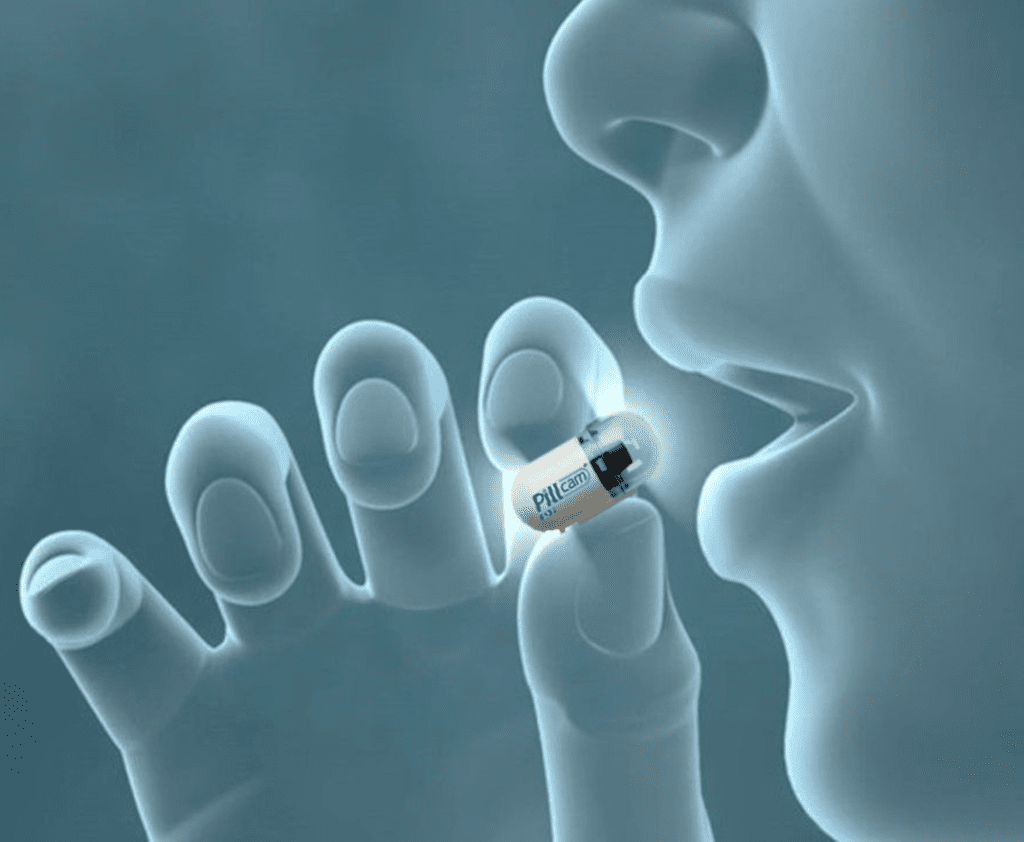 Graphic demonstrating a subject swallowing a colon capsule pill camera